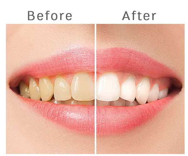 product-600-500 product-600-500